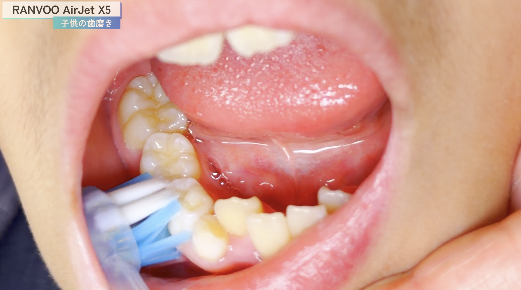 AirJet X5 使用感・ブラシヘッド